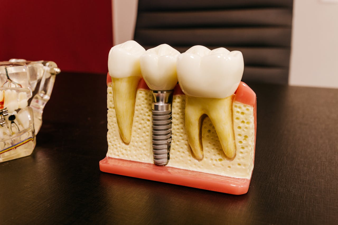 Close-up of a dental implant model on a professional workspace desk.